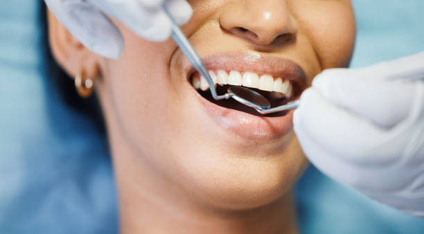Best Urgent Dental Care  in Fircrest, WA