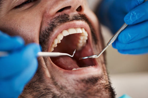 Best Urgent Tooth Repair  in Fircrest, WA